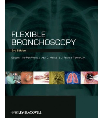 Flexible Bronchoscopy, 3rd Edition